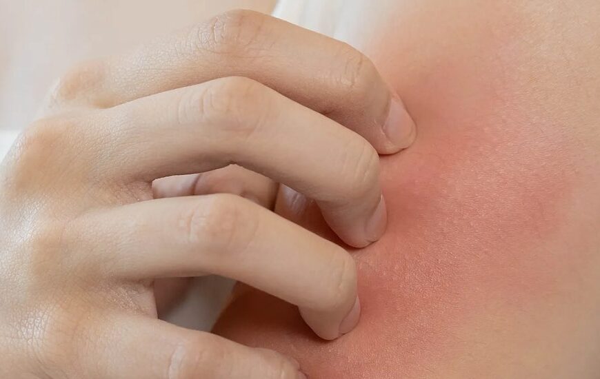 Nuevo método para evaluar sensibilización dérmica sin utilizar animales 